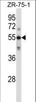 Complement C9 Antibody - C9 Antibody western blot of ZR-75-1 cell line lysates (35 ug/lane). The C9 antibody detected the C9 protein (arrow).