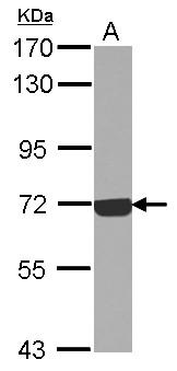 Complement C9 Antibody - Sample (30 ug of whole cell lysate) A: Jurkat 7.5% SDS PAGE C9 antibody diluted at 1:1000