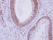 Complement C9 Antibody - IHC of paraffin-embedded Normal Colon, using C9 antibody at 1:250 dilution.