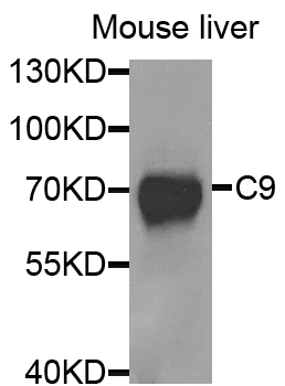 Complement C9 Antibody - Western blot analysis of extracts of mouse liver.