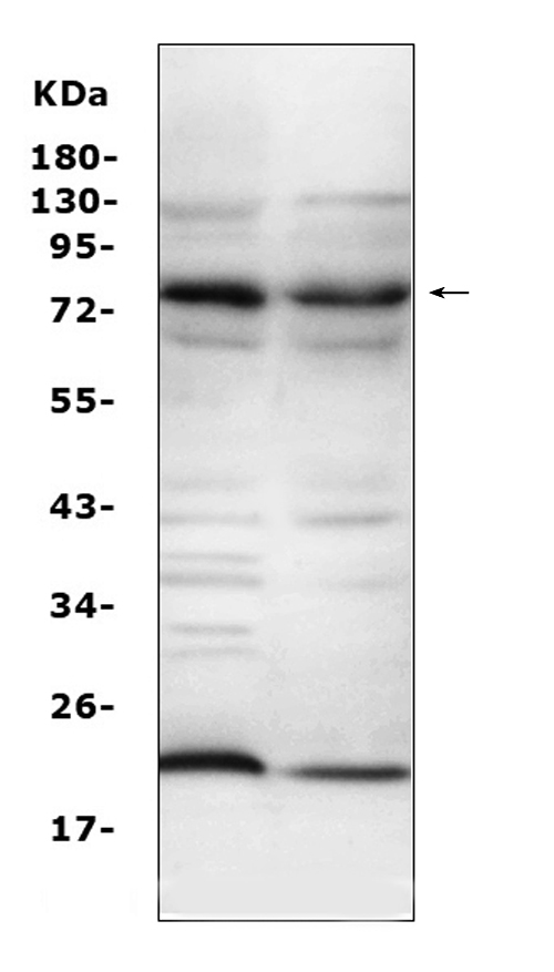 Complement C9 Antibody - Western blot analysis of Complement C9 using anti-Complement C9 antibody. Electrophoresis was performed on a 5-20% SDS-PAGE gel at 70V (Stacking gel) / 90V (Resolving gel) for 2-3 hours. The sample well of each lane was loaded with 50ug of sample under reducing conditions. Lane 1: mouse liver tissue lysates, Lane 2: mouse lung tissue lysates, After Electrophoresis, proteins were transferred to a Nitrocellulose membrane at 150mA for 50-90 minutes. Blocked the membrane with 5% Non-fat Milk/ TBS for 1.5 hour at RT. The membrane was incubated with rabbit anti-Complement C9 antigen affinity purified polyclonal antibody at 0.5 µg/mL overnight at 4°C, then washed with TBS-0.1% Tween 3 times with 5 minutes each and probed with a goat anti-rabbit IgG-HRP secondary antibody at a dilution of 1:10000 for 1.5 hour at RT. The signal is developed using an Enhanced Chemiluminescent detection (ECL) kit with Tanon 5200 system. A specific band was detected for Complement C9 at approximately 80KD. The expected band size for Complement C9 is at 63KD.