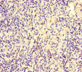 Complement C9 Antibody - Immunohistochemistry of paraffin-embedded human spleen tissue at dilution of 1:100