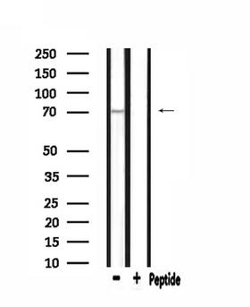 Complement C9 Antibody - Western blot analysis of extracts of mouse lung using C9 antibody.