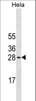 COMT Antibody - COMT Antibody (Ascites)western blot of HeLa cell line lysates (35 ug/lane). The COMT antibody detected the COMT protein (arrow).