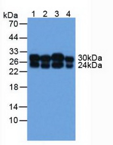 COMT Antibody - Western Blot; Sample: Lane1: Human A549 Cells; Lane2: Human MCF7 Cells; Lane3: Human Liver Tissue; Lane4: Human 293T Cells.