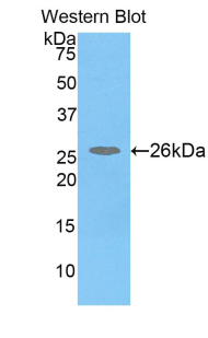 COMT Antibody - Western blot of recombinant COMT.  This image was taken for the unconjugated form of this product. Other forms have not been tested.