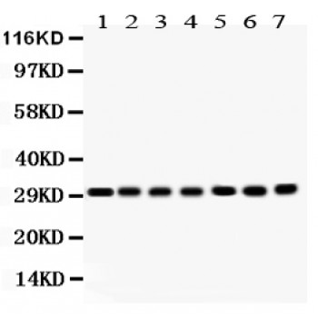 COMT Antibody - COMT antibody Western blot. All lanes: Anti COMT at 0.5 ug/ml. Lane 1: Rat Brain Tissue Lysate at 50 ug. Lane 2: Rat Liver Tissue Lysate at 50 ug. Lane 3: Rat Kidney Tissue Lysate at 50 ug. Lane 4: Mouse Brain Tissue Lysate at 50 ug. Lane 5: JURKAT Whole Cell Lysate at 40 ug. Lane 6: CEM Whole Cell Lysate at 40 ug. Lane 7: HELA Whole Cell Lysate at 40 ug. Predicted band size: 30 kD. Observed band size: 30 kD.