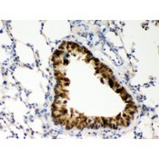 COMT Antibody - COMT antibody IHC-paraffin. IHC(P): Mouse Lung Tissue.