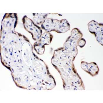 COMT Antibody - COMT antibody IHC-paraffin. IHC(P): Human Placenta Tissue.