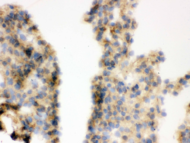 COMT Antibody - IHC analysis of COMT using anti-COMT antibody. COMT was detected in frozen section of mouse lung tissue . Heat mediated antigen retrieval was performed in citrate buffer (pH6, epitope retrieval solution) for 20 mins. The tissue section was blocked with 10% goat serum. The tissue section was then incubated with 1µg/ml rabbit anti-COMT Antibody overnight at 4°C. Biotinylated goat anti-rabbit IgG was used as secondary antibody and incubated for 30 minutes at 37°C. The tissue section was developed using Strepavidin-Biotin-Complex (SABC) with DAB as the chromogen.