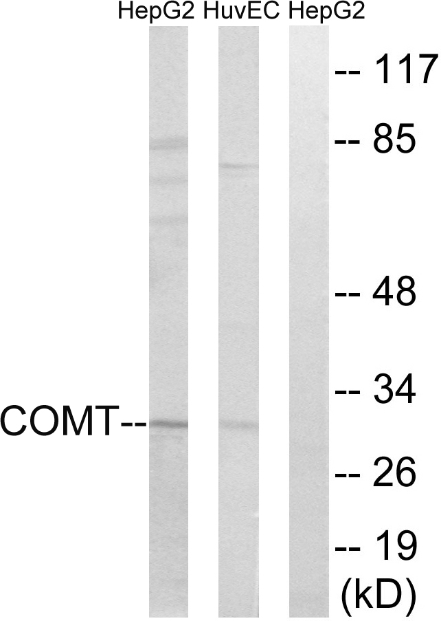 COMT Antibody - Western blot analysis of lysates from HUVEC and HepG2 cells, using COMT Antibody. The lane on the right is blocked with the synthesized peptide.