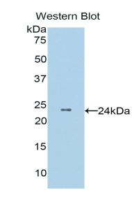 COMT Antibody - Western blot of recombinant COMT.  This image was taken for the unconjugated form of this product. Other forms have not been tested.