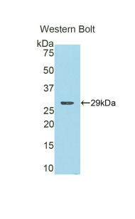COMT Antibody - Western blot of recombinant COMT.  This image was taken for the unconjugated form of this product. Other forms have not been tested.