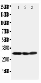 COMT Antibody - WB of COMT antibody. Lane 1: HELA Cell Lysate. Lane 2: A375 Cell Lysate. Lane 3: PANC Cell Lysate.