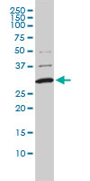 COMT Antibody - COMT monoclonal antibody (M01), clone 1G4-1A1 Western Blot analysis of COMT expression in A-431.