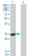 COMT Antibody - Western Blot analysis of COMT expression in transfected 293T cell line by COMT monoclonal antibody (M01), clone 1G4-1A1.Lane 1: COMT transfected lysate(24.4 KDa).Lane 2: Non-transfected lysate.