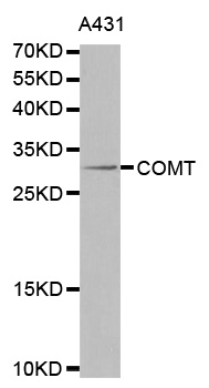 COMT Antibody - Western blot analysis of extracts of A431 cells lines, using COMT antibody.
