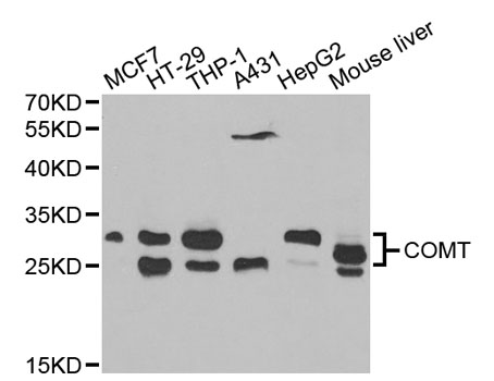 COMT Antibody - Western blot analysis of extracts of various cell lines, using COMT antibody at 1:1000 dilution. The secondary antibody used was an HRP Goat Anti-Rabbit IgG (H+L) at 1:10000 dilution. Lysates were loaded 25ug per lane and 3% nonfat dry milk in TBST was used for blocking. An ECL Kit was used for detection and the exposure time was 60s.