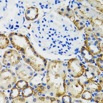 COMT Antibody - Immunohistochemistry of paraffin-embedded mouse kidney tissue.