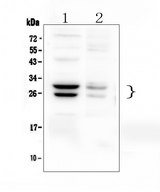 COMT Antibody - Western blot analysis of COMT using anti-COMT antibody. Electrophoresis was performed on a 5-20% SDS-PAGE gel at 70V (Stacking gel) / 90V (Resolving gel) for 2-3 hours. The sample well of each lane was loaded with 50ug of sample under reducing conditions. Lane 1: mouse liver tissue lysates,Lane 2: mouse stomach tissue lysates. After Electrophoresis, proteins were transferred to a Nitrocellulose membrane at 150mA for 50-90 minutes. Blocked the membrane with 5% Non-fat Milk/ TBS for 1.5 hour at RT. The membrane was incubated with rabbit anti-COMT antigen affinity purified polyclonal antibody at 0.5 µg/mL overnight at 4°C, then washed with TBS-0.1% Tween 3 times with 5 minutes each and probed with a goat anti-rabbit IgG-HRP secondary antibody at a dilution of 1:10000 for 1.5 hour at RT. The signal is developed using an Enhanced Chemiluminescent detection (ECL) kit with Tanon 5200 system. A specific band was detected for COMT at approximately 25 and 29KD. The expected band size for COMT is at 29KD.