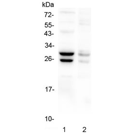 COMT Antibody - Western blot testing of 1) mouse liver and 2) mouse stomach lysate with COMT antibody at 0.5ug//ml. Predicted molecular weight: ~30/25 kDa (isoforms 1/2).