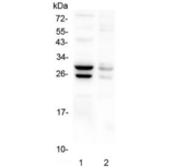 COMT Antibody - Western blot testing of 1) mouse liver and 2) mouse stomach lysate with COMT antibody at 0.5ug//ml. Predicted molecular weight: ~30/25 kDa (isoforms 1/2).