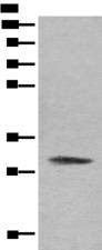 COMT Antibody - Western blot analysis of Hela cell lysate  using COMT Polyclonal Antibody at dilution of 1:450