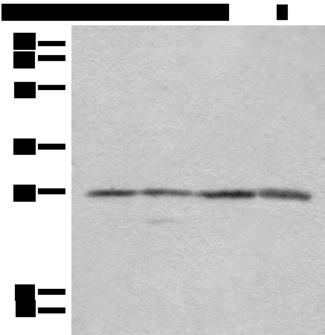 COMT Antibody - Western blot analysis of 293T Jurkat and 231 cell lysates  using COMT Polyclonal Antibody at dilution of 1:350