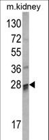 COMTD1 Antibody - Western blot of COMTD1 Antibody in mouse kidney tissue lysates (35 ug/lane). COMTD1 (arrow) was detected using the purified antibody.