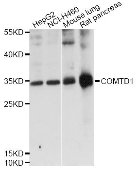 COMTD1 Antibody - Western blot analysis of extracts of various cell lines, using COMTD1 antibody at 1:1000 dilution. The secondary antibody used was an HRP Goat Anti-Rabbit IgG (H+L) at 1:10000 dilution. Lysates were loaded 25ug per lane and 3% nonfat dry milk in TBST was used for blocking. An ECL Kit was used for detection and the exposure time was 15s.