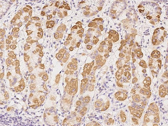 COMTD1 Antibody - Immunochemical staining of human COMTD1 in human stomach with rabbit polyclonal antibody at 1:100 dilution, formalin-fixed paraffin embedded sections.