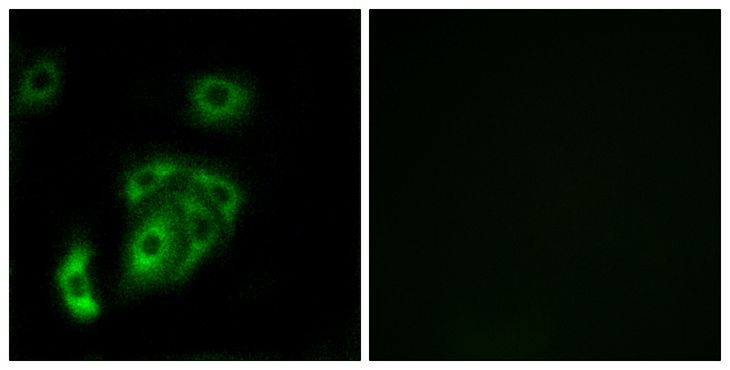Contactin-5 / CNTN5 Antibody - Immunofluorescence analysis of A549 cells, using CNTN5 Antibody. The picture on the right is blocked with the synthesized peptide.