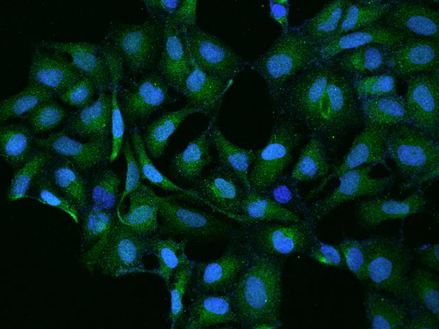 Contactin-5 / CNTN5 Antibody - Immunofluorescence staining of CNTN5 in U2OS cells. Cells were fixed with 4% PFA, permeabilzed with 0.1% Triton X-100 in PBS, blocked with 10% serum, and incubated with rabbit anti-Human CNTN5 polyclonal antibody (dilution ratio 1:100) at 4°C overnight. Then cells were stained with the Alexa Fluor 488-conjugated Goat Anti-rabbit IgG secondary antibody (green) and counterstained with DAPI (blue). Positive staining was localized to Cytoplasm.