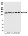 COPA / Xenin Antibody - Detection of human and mouse COPA by western blot. Samples: Whole cell lysate (50 µg) from HeLa, HEK293T, Jurkat, mouse TCMK-1, and mouse NIH 3T3 cells prepared using NETN lysis buffer. Antibody: Affinity purified rabbit anti-COPA antibody used for WB at 0.1 µg/ml. Detection: Chemiluminescence with an exposure time of 30 seconds.