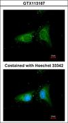 COPB1 / Beta-COP Antibody - Immunofluorescence of methanol-fixed HeLa, using COPB antibody at 1:100 dilution.