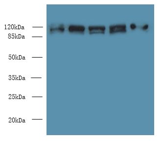 COPB1 / Beta-COP Antibody - Western blot. All lanes: COPB1 antibody at 1 ug/ml. Lane 1: HeLa whole cell lysate. Lane 2: Jurkat whole cell lysate. Lane 3: NIH/3T3 whole cell lysate. Lane 4: Mouse liver tissue. Lane 5: A549 whole cell lysate. Secondary antibody: Goat polyclonal to Rabbit IgG at 1:10000 dilution. Predicted band size: 107 kDa. Observed band size: 107 kDa.