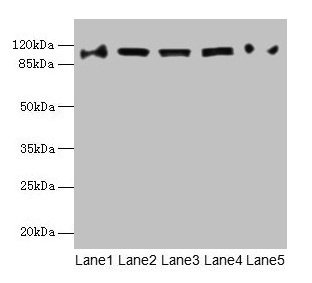 COPB1 / Beta-COP Antibody - Western blot All lanes: COPB1 antibody at 1µg/ml Lane 1: Hela whole cell lysate Lane 2: Jurkat whole cell lysate Lane 3: NIH/3T3 whole cell lysate Lane 4: Mouse liver tissue Lane 5: A549 whole cell lysate Secondary Goat polyclonal to rabbit IgG at 1/10000 dilution Predicted band size: 107 kDa Observed band size: 107 kDa