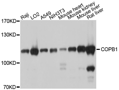 COPB1 / Beta-COP Antibody - Western blot analysis of extracts of various cell lines, using COPB1 antibody at 1:1000 dilution. The secondary antibody used was an HRP Goat Anti-Rabbit IgG (H+L) at 1:10000 dilution. Lysates were loaded 25ug per lane and 3% nonfat dry milk in TBST was used for blocking. An ECL Kit was used for detection and the exposure time was 1s.