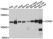 COPB1 / Beta-COP Antibody - Western blot analysis of extracts of various cell lines, using COPB1 antibody at 1:1000 dilution. The secondary antibody used was an HRP Goat Anti-Rabbit IgG (H+L) at 1:10000 dilution. Lysates were loaded 25ug per lane and 3% nonfat dry milk in TBST was used for blocking. An ECL Kit was used for detection and the exposure time was 1s.