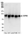 COPB2 / Beta-COP Antibody - Detection of human and mouse COPB2 by western blot. Samples: Whole cell lysate (50 µg) from HeLa, HEK293T, Jurkat, mouse TCMK-1, and mouse NIH 3T3 cells prepared using NETN lysis buffer. Antibodies: Affinity purified rabbit anti-COPB2 antibody used for WB at 0.1 µg/ml. Detection: Chemiluminescence with an exposure time of 30 seconds.