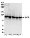 COPB2 / Beta-COP Antibody - Detection of human and mouse COPB2 by western blot. Samples: Whole cell lysate (50 µg) from HeLa, HEK293T, Jurkat, mouse TCMK-1, and mouse NIH 3T3 cells prepared using NETN lysis buffer. Antibodies: Affinity purified rabbit anti-COPB2 antibody used for WB at 0.1 µg/ml. Detection: Chemiluminescence with an exposure time of 30 seconds.