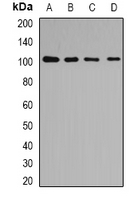 COPB2 / Beta-COP Antibody - Western blot analysis of p102 expression in HeLa (A); HepG2 (B); mouse liver (C); mouse kidney (D) whole cell lysates.