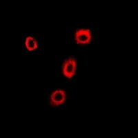 COPB2 / Beta-COP Antibody - Immunofluorescent analysis of p102 staining in U2OS cells. Formalin-fixed cells were permeabilized with 0.1% Triton X-100 in TBS for 5-10 minutes and blocked with 3% BSA-PBS for 30 minutes at room temperature. Cells were probed with the primary antibody in 3% BSA-PBS and incubated overnight at 4 deg C in a humidified chamber. Cells were washed with PBST and incubated with a DyLight 594-conjugated secondary antibody (red) in PBS at room temperature in the dark.