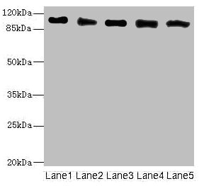 COPB2 / Beta-COP Antibody - Western blot All Lanes: COPB2 antibody at 2.51ug/ml Lane 1: Human placenta tissue Lane 2: MCF7 whole cell lysate Lane 3: Hela whole cell lysate Lane 4: HepG-2 whole cell lysate Lane 5: Jurkat whole cell lysate Secondary Goat polyclonal to rabbit IgG at 1/10000 dilution Predicted band size: 103,100 kDa Observed band size: 102 kDa