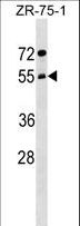 COPD / ARCN1 Antibody - ARCN1 Antibody western blot of ZR-75-1 cell line lysates (35 ug/lane). The ARCN1 antibody detected the ARCN1 protein (arrow).
