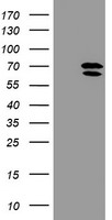 COPD / ARCN1 Antibody - HEK293T cells were transfected with the pCMV6-ENTRY control (Left lane) or pCMV6-ENTRY ARCN1 (Right lane) cDNA for 48 hrs and lysed. Equivalent amounts of cell lysates (5 ug per lane) were separated by SDS-PAGE and immunoblotted with anti-ARCN1.