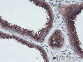 COPD / ARCN1 Antibody - IHC of paraffin-embedded Human breast tissue using anti-ARCN1 mouse monoclonal antibody.