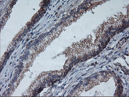 COPD / ARCN1 Antibody - IHC of paraffin-embedded Human prostate tissue using anti-ARCN1 mouse monoclonal antibody.