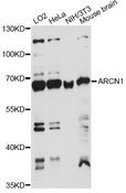 COPD / ARCN1 Antibody - Western blot analysis of extracts of various cell lines, using ARCN1 antibody at 1:1000 dilution. The secondary antibody used was an HRP Goat Anti-Rabbit IgG (H+L) at 1:10000 dilution. Lysates were loaded 25ug per lane and 3% nonfat dry milk in TBST was used for blocking. An ECL Kit was used for detection and the exposure time was 60s.