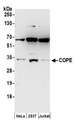 COPE Antibody - Detection of human COPE by western blot. Samples: Whole cell lysate (50 µg) from HeLa, HEK293T, and Jurkat cells prepared using NETN lysis buffer. Antibodies: Affinity purified rabbit anti-COPE antibody used for WB at 1 µg/ml. Detection: Chemiluminescence with an exposure time of 30 seconds.